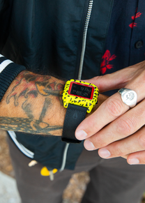 Rolling Stones Staple Yellow / Black View 9